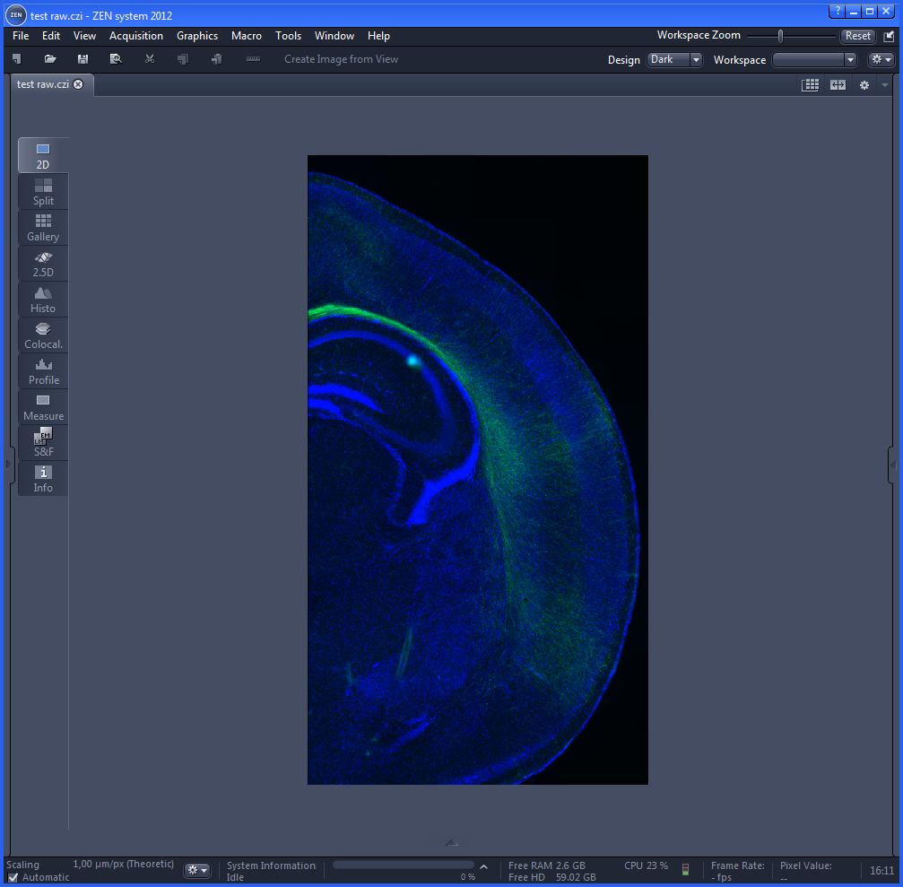 Bug 677 – CZI Tile Image does not open correctly with BioFormats 5 in Fiji